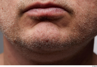  HD Face Skin Yury chin face lips mouth skin pores skin texture 0002.jpg